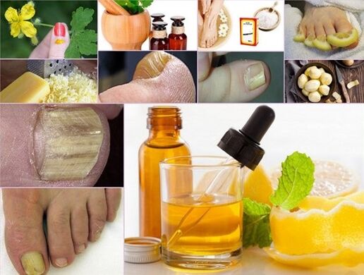 Folk remedies for treating fungus on toenails