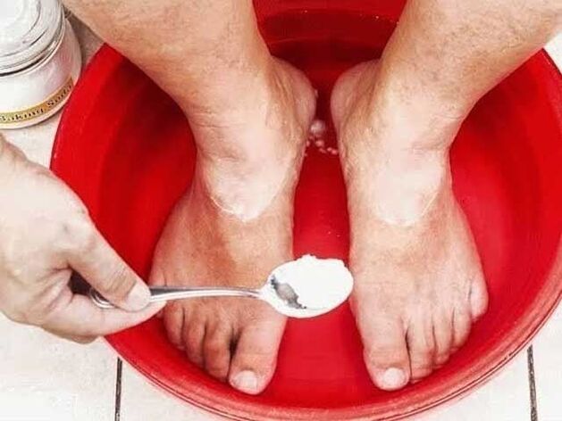 Soda baths for fungi