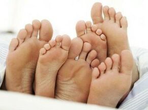 Healthy feet after treating fungus between toes