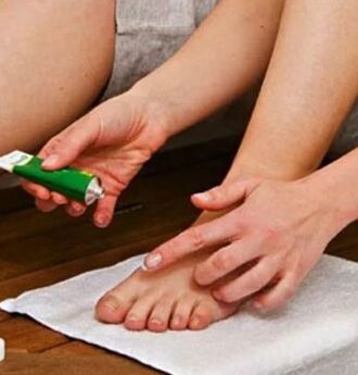 The use of a therapeutic ointment to combat the nail of the big toe with a fungus